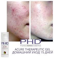 THERAPEUTIC GEL-Противовоспалительный гель для жирной и проблемной кожи-изображение_2